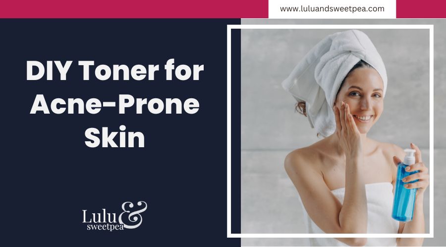 DIY Toner for Acne-Prone Skin