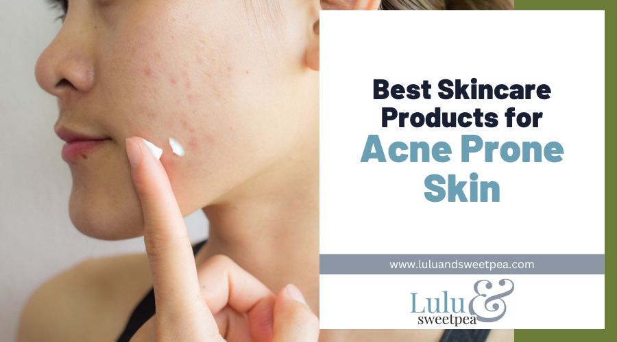 Best Skincare Products for Acne Prone Skin
