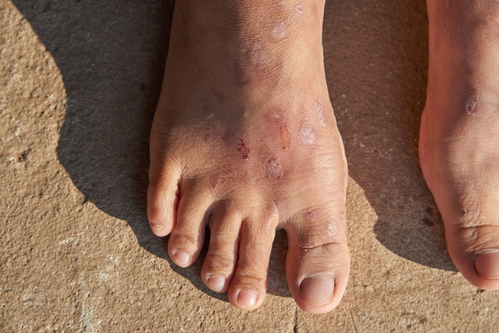 a lot of scars on woman feet