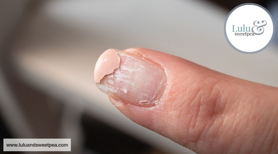 Why Does My Gel Polish Peel Off So Quickly Understanding Common Causes and Prevention Tips
